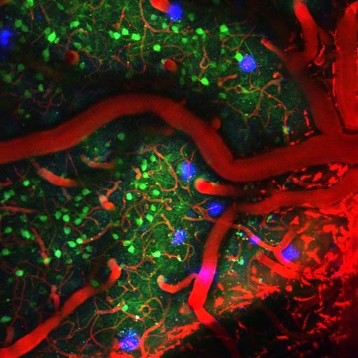 Two-photon imaging of GCaMP in neurons, Texas Red Dextran in vessels, and Methoxy-X04 labelling amyloid-β plaques in mouse visual cortex.