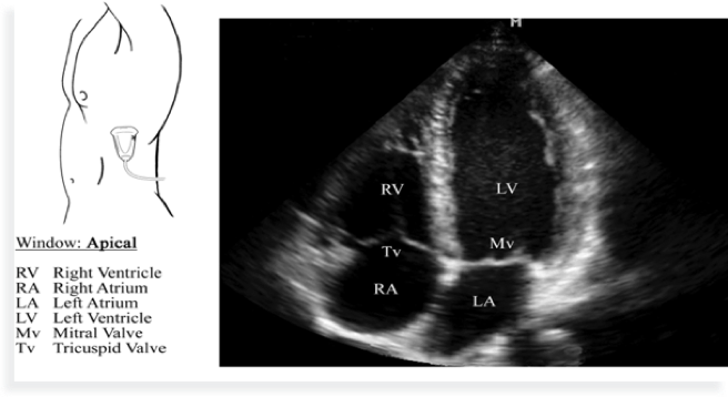 apical