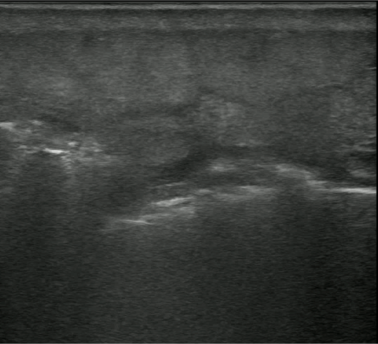 fluid stripe