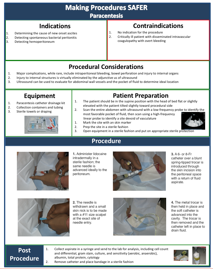 Paracentesis