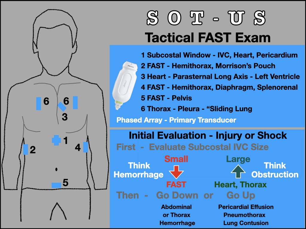 Tactical POCUS