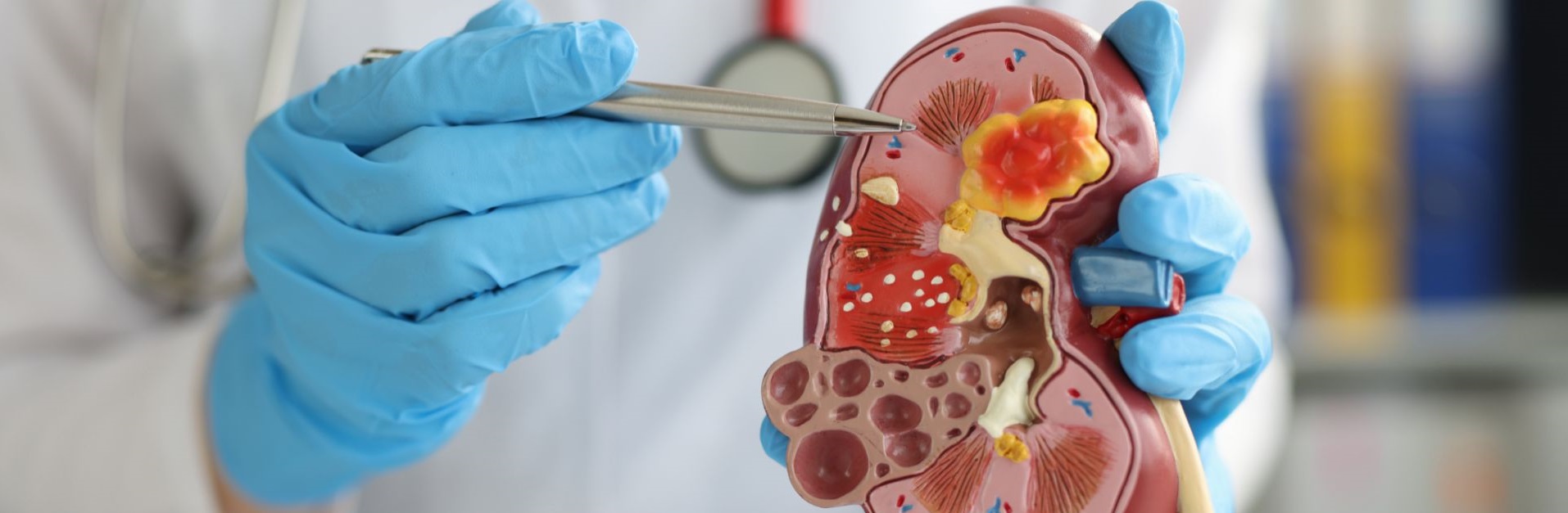 Doctor pointing at a kidney model