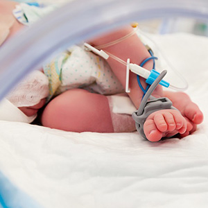 ECMO Baby Feet