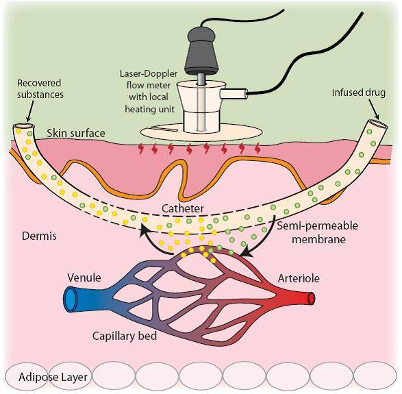 cutaneous microdialysis