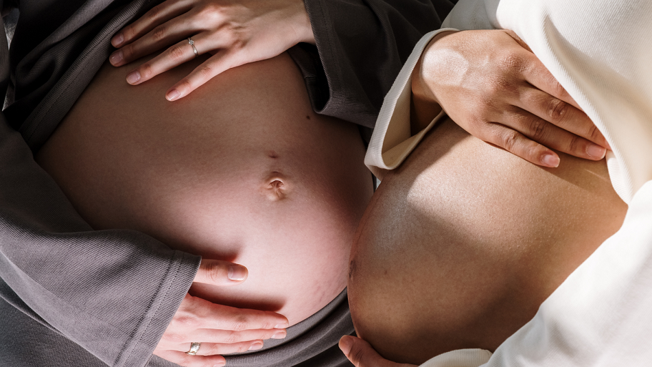 pregnant women showing off their tummies