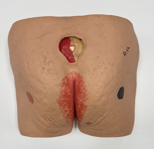 Wound Care Trainer by Seymour Butts Model