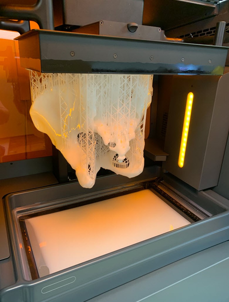 3D printed pelvis on the Formlabs Form 3L